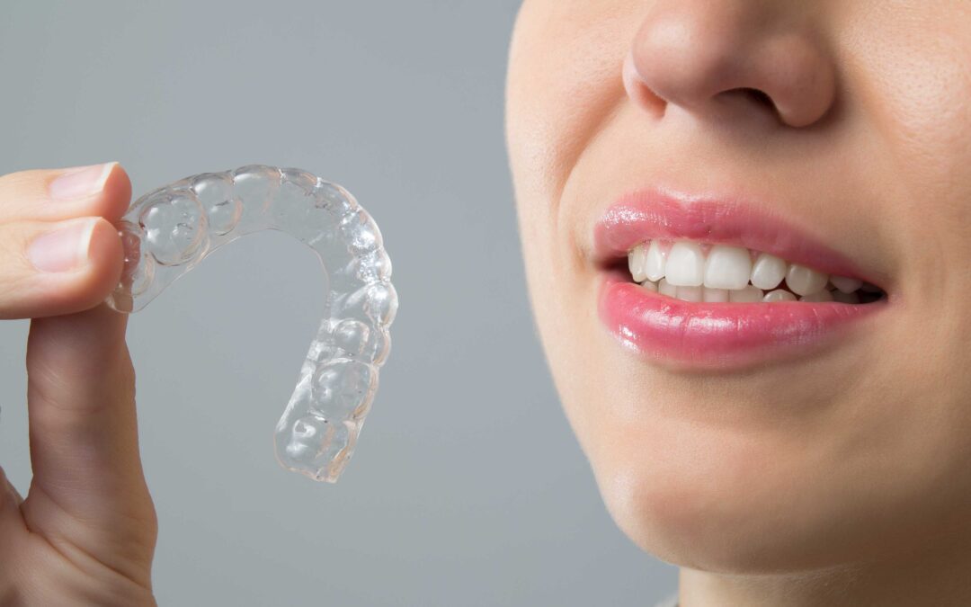 Invisalign mistakes