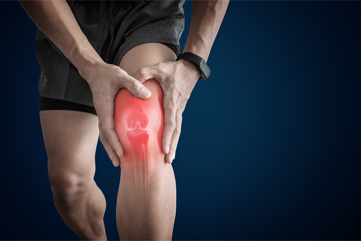 Arthritis Supplements