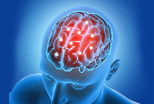 Stroke Treatment Doctors Near Me – Fast & Reliable Care
