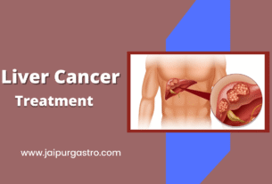 Best Liver Cancer Treatment in Jaipur | Advanced Care & Specialists